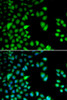 Cell Cycle Antibodies 1 Anti-RPS6KA3 Antibody CAB5436