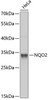 Cell Biology Antibodies 9 Anti-NQO2 Antibody CAB5440