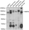 Cell Biology Antibodies 9 Anti-MERTK Antibody CAB5443