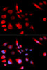 Cell Cycle Antibodies 1 Anti-KIF2C Antibody CAB5449