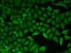 Cell Cycle Antibodies 1 Anti-CDC34 Antibody CAB5457