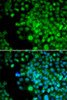 Developmental Biology Anti-FHL1 Antibody CAB5460