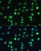 Metabolism Antibodies 2 Anti-LBR Antibody CAB5468