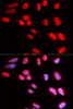 Epigenetics and Nuclear Signaling Antibodies 3 Anti-PRPF3 Antibody CAB5482
