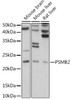 Immunology Antibodies 2 Anti-PSMB2 Antibody CAB5483