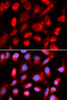 Metabolism Antibodies 2 Anti-UROD Antibody CAB5493