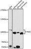 Cell Biology Antibodies 9 Anti-PKP2 Antibody CAB5507