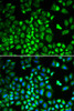 Cell Biology Antibodies 9 Anti-HAX1 Antibody CAB5551