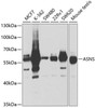 Metabolism Antibodies 2 Anti-ASNS Antibody CAB5558