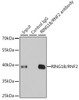 Epigenetics and Nuclear Signaling Antibodies 3 Anti-RING1B/RNF2 Antibody CAB5563