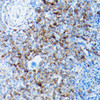 Signal Transduction Antibodies 3 Anti-SLC8A1 Antibody CAB5583