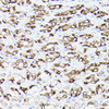 Signal Transduction Antibodies 3 Anti-SLC8A1 Antibody CAB5583