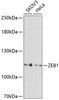 Developmental Biology Anti-ZEB1 Antibody CAB5600