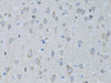 Cell Death Antibodies 2 Anti-GABARAP Antibody CAB5616