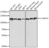 KO Validated Antibodies 1 Anti-Alpha-Catenin Antibody CAB5635KO Validated