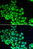 Epigenetics and Nuclear Signaling Antibodies 2 Anti-ERCC2 Antibody CAB5640