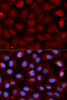 Epigenetics and Nuclear Signaling Antibodies 2 Anti-FMR1 Antibody CAB5645