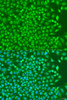 Cell Biology Antibodies 9 Anti-NKX2-5 Antibody CAB5651