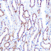 Epigenetics and Nuclear Signaling Antibodies 2 Anti-Smad4 Antibody CAB5657