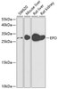 Immunology Antibodies 2 Anti-EPO Antibody CAB5663