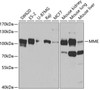 Cell Biology Antibodies 9 Anti-MME Antibody CAB5664