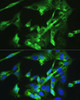 Cell Biology Antibodies 9 Anti-BMPR2 Antibody CAB5666