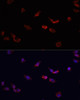 Cell Biology Antibodies 9 Anti-BMPR2 Antibody CAB5666