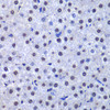 Cell Biology Antibodies 9 Anti-GSTP1 Antibody CAB5691