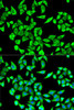 Cell Biology Antibodies 9 Anti-ROCK2 Antibody CAB5698