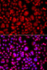 Cell Death Antibodies 2 Anti-TP53BP2 Antibody CAB5704