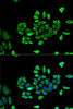 Signal Transduction Antibodies 3 Anti-CLCN5 Antibody CAB5707