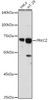 Immunology Antibodies 2 Anti-PRKCZ Antibody CAB5714