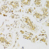 Cell Death Antibodies 2 Anti-Caspase-2 Antibody CAB5724