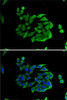 Cell Biology Antibodies 9 Anti-Heparanase 1 Antibody CAB5726