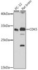 Cell Death Antibodies 2 Anti-CDK5 Antibody CAB5730