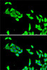 Cell Death Antibodies 2 Anti-CDK5 Antibody CAB5730