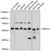Epigenetics and Nuclear Signaling Antibodies 2 Anti-PRPF31 Antibody CAB5732