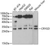 Signal Transduction Antibodies 3 Anti-CRYGD Antibody CAB5740