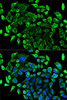 Cell Biology Antibodies 9 Anti-TAB1 Antibody CAB5749