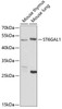 Cell Biology Antibodies 9 Anti-ST6GAL1 Antibody CAB5754