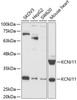 Signal Transduction Antibodies 3 Anti-KCNJ11 Antibody CAB5765