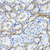 Cell Biology Antibodies 9 Anti-PEX5 Antibody CAB5780