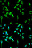 Epigenetics and Nuclear Signaling Antibodies 2 Anti-TOPBP1 Antibody CAB5781