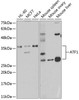 Epigenetics and Nuclear Signaling Antibodies 2 Anti-ATF1 Antibody CAB5791