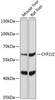 Metabolism Antibodies 2 Anti-CYP2J2 Antibody CAB5805