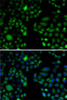 Developmental Biology Anti-EPC1 Antibody CAB5807