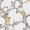 Autophagy Antibodies Anti-ATG3 Antibody CAB5809