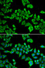 Epigenetics and Nuclear Signaling Antibodies 2 Anti-DDX20 Antibody CAB5817