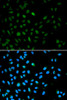 Epigenetics and Nuclear Signaling Antibodies 2 Anti-EZH1 Antibody CAB5818