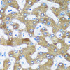 Cell Death Antibodies 2 Anti-RMDN3 Antibody CAB5820